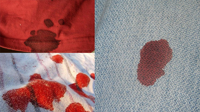 Как избавиться от пятен крови на одежде